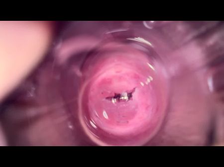mia_teens