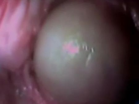 penis in kitzler
